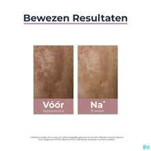 Afbeelding in Gallery-weergave laden, mediPimId:360541:1730971133
